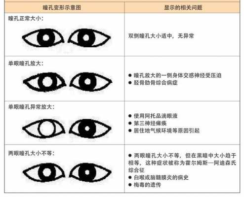 瞳孔向内什么瘫痪（瞳孔位置偏内）