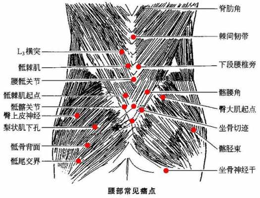 什么是骶棘肌痉挛（骶棘肌痉挛症临床表现）