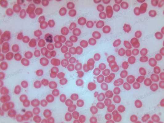红细胞是什么染色（红细胞是什么染色的）