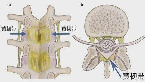 黄韧带协助围成什么（黄韧带连接于什么之间）