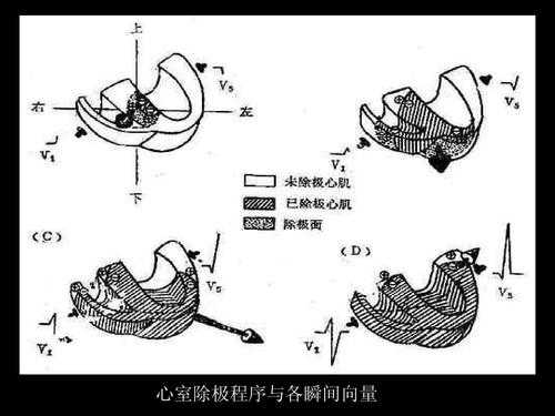 心室除极是为了什么（心室除极是心室收缩吗）